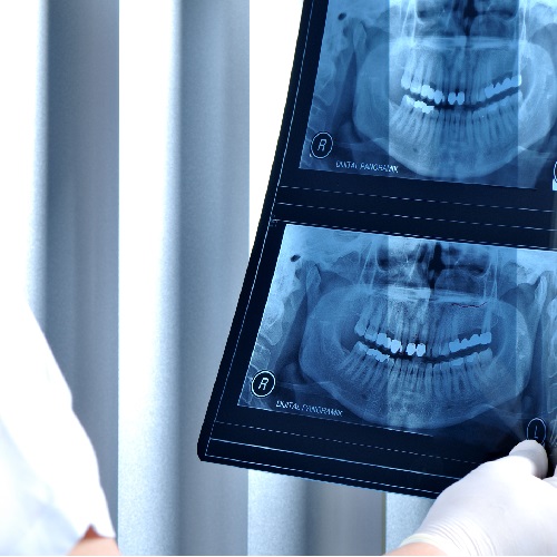 Image representing P174 Radiography for Dentists (Operator) and Dental Radiographers (Course 1): IRMER, Properties of Radiation, Radiation Hazards and Dosimetry 